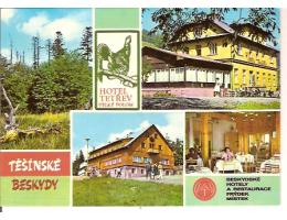 HOTEL TETŘEV / HORNÍ LOMNÁ / BESKYDY *A--1132